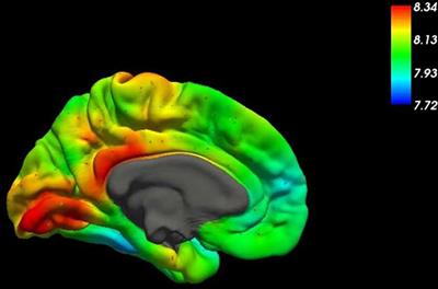 Dysfunction of the Blood-Brain Barrier—A Key Step in Neurodegeneration and Dementia